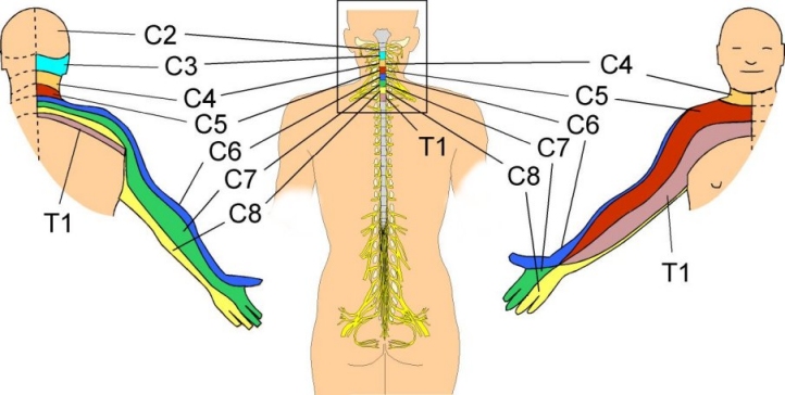 dermatomas_ms