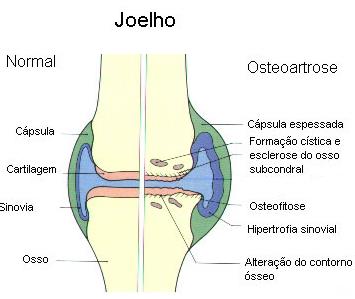 joelho